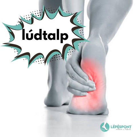 Mi az a lúdtalp? Kényelmes cipő lúdtalpas lábra